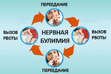 Лечение булимии в Вятских Полянах